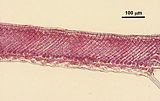 3 - Sezione longitudinale radiale